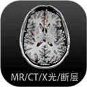 影像解剖图谱app官方下载安装